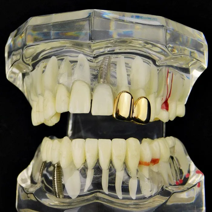 PreStyled Sets 14K Gold Plated Double Caps Left Hand Teeth Bling Cartel Admin