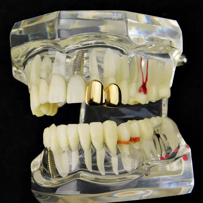 PreStyled Sets 14K Gold Plated Double Caps Left Hand Teeth Bling Cartel Admin