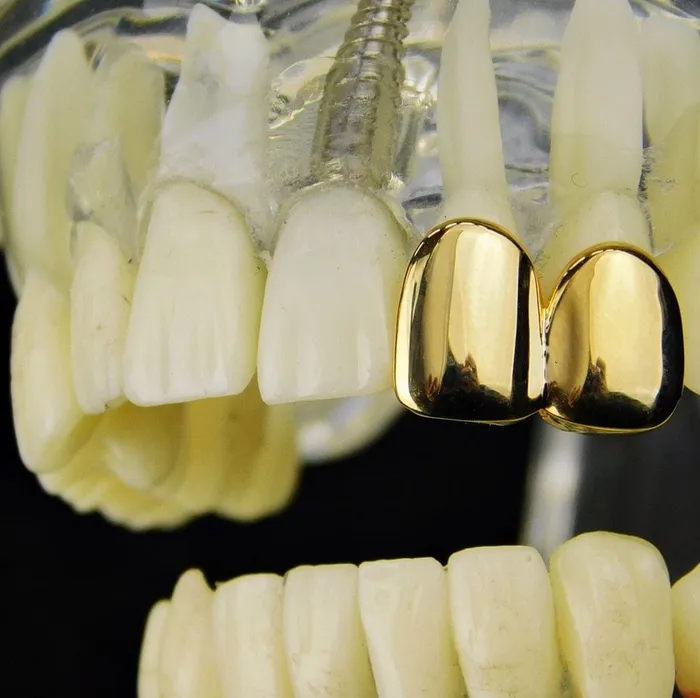 PreStyled Sets 14K Gold Plated Double Caps Left Hand Teeth Bling Cartel Admin