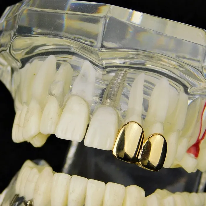 PreStyled Sets 14K Gold Plated Double Caps Left Hand Teeth Bling Cartel Admin